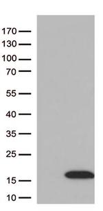 DBI Antibody in Western Blot (WB)