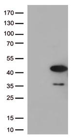 AMPK beta 1 (PRKAB1) Antibody in Western Blot (WB)
