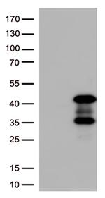 AMPK beta 1 (PRKAB1) Antibody in Western Blot (WB)