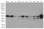AMPK beta 1 (PRKAB1) Antibody in Western Blot (WB)