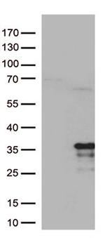 MRPL24 Antibody in Western Blot (WB)