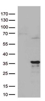 MRPL24 Antibody in Western Blot (WB)