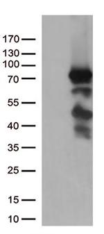 PDZK1 Antibody in Western Blot (WB)