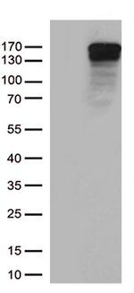 TRPS1 Antibody in Western Blot (WB)