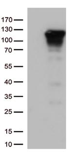 NFKB1 Antibody in Western Blot (WB)