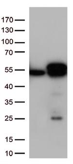 Calreticulin (CALR) Antibody in Western Blot (WB)