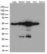 Calreticulin (CALR) Antibody in Western Blot (WB)