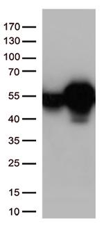 Calreticulin (CALR) Antibody in Western Blot (WB)