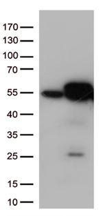 Calreticulin (CALR) Antibody in Western Blot (WB)