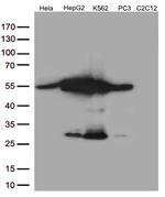 Calreticulin (CALR) Antibody in Western Blot (WB)
