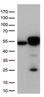 Calreticulin (CALR) Antibody in Western Blot (WB)
