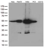 Calreticulin (CALR) Antibody in Western Blot (WB)