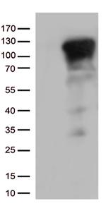NFKB1 Antibody in Western Blot (WB)
