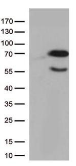 GNL3 Antibody in Western Blot (WB)