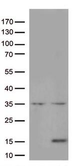 IL8 Antibody in Western Blot (WB)