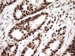 KAP1 (TRIM28) Antibody in Immunohistochemistry (Paraffin) (IHC (P))