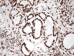 KAP1 (TRIM28) Antibody in Immunohistochemistry (Paraffin) (IHC (P))