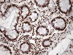 KAP1 (TRIM28) Antibody in Immunohistochemistry (Paraffin) (IHC (P))