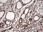 KAP1 (TRIM28) Antibody in Immunohistochemistry (Paraffin) (IHC (P))