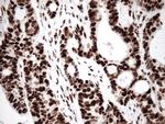 KAP1 (TRIM28) Antibody in Immunohistochemistry (Paraffin) (IHC (P))