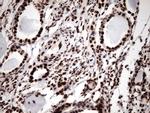 KAP1 (TRIM28) Antibody in Immunohistochemistry (Paraffin) (IHC (P))