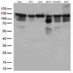 KAP1 (TRIM28) Antibody in Western Blot (WB)