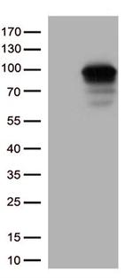 DDX4 Antibody in Western Blot (WB)