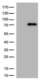 PRKCA Antibody in Western Blot (WB)