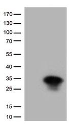 HSPB1 Antibody in Western Blot (WB)