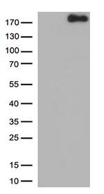 NPHS1 Antibody in Western Blot (WB)