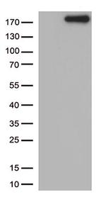 NPHS1 Antibody in Western Blot (WB)
