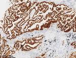 NAPSA Antibody in Immunohistochemistry (Paraffin) (IHC (P))