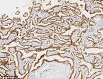 NAPSA Antibody in Immunohistochemistry (Paraffin) (IHC (P))