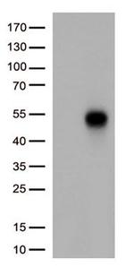 TNFRSF14 Antibody in Western Blot (WB)