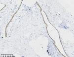 FOXP1 Antibody in Immunohistochemistry (Paraffin) (IHC (P))