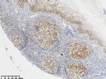 MLH1 Antibody in Immunohistochemistry (Paraffin) (IHC (P))