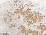 p120-catenin Antibody in Immunohistochemistry (Paraffin) (IHC (P))