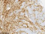 SDC1 Antibody in Immunohistochemistry (Paraffin) (IHC (P))