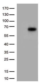 IL3RA Antibody in Western Blot (WB)