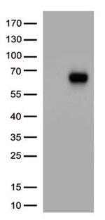 IL3RA Antibody in Western Blot (WB)
