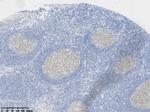 BCL-6 Antibody in Immunohistochemistry (Paraffin) (IHC (P))