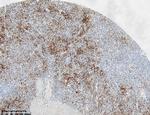 CD61 Antibody in Immunohistochemistry (Paraffin) (IHC (P))