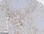 CD61 Antibody in Immunohistochemistry (Paraffin) (IHC (P))