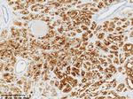PSMA Antibody in Immunohistochemistry (Paraffin) (IHC (P))