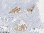 CD21 Antibody in Immunohistochemistry (Paraffin) (IHC (P))