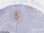 CD21 Antibody in Immunohistochemistry (Paraffin) (IHC (P))