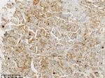 MSLN Antibody in Immunohistochemistry (Paraffin) (IHC (P))