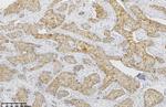 GS Antibody in Immunohistochemistry (Paraffin) (IHC (P))