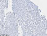 Perforin-1 Antibody in Immunohistochemistry (Paraffin) (IHC (P))