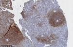 CD21 Antibody in Immunohistochemistry (Paraffin) (IHC (P))
